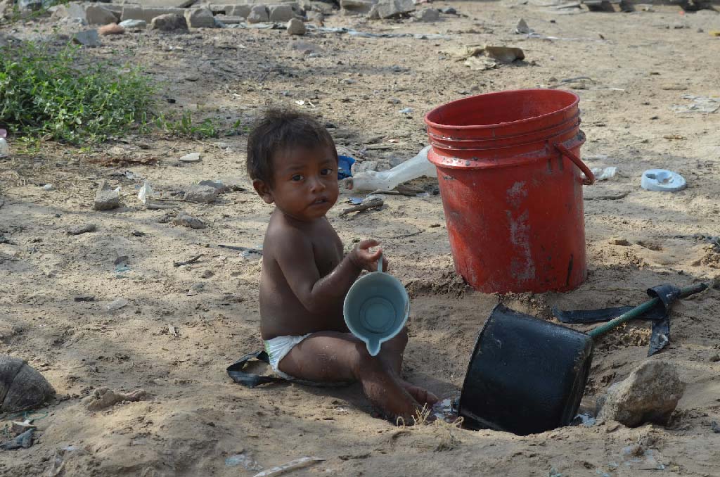 La Guajira children, Malnutrition La Gaujira
