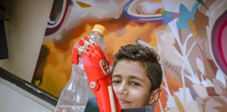 Young boy holds up a water bottle with his new prosthetic arm