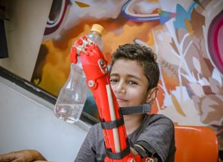 Young boy holds up a water bottle with his new prosthetic arm