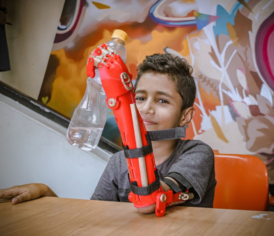 Young boy holds up a water bottle with his new prosthetic arm